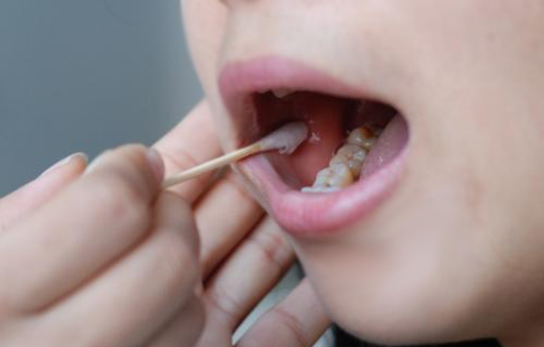 福州匿名亲子鉴定需要的条件和材料有哪些,福州隐私亲子鉴定收费明细